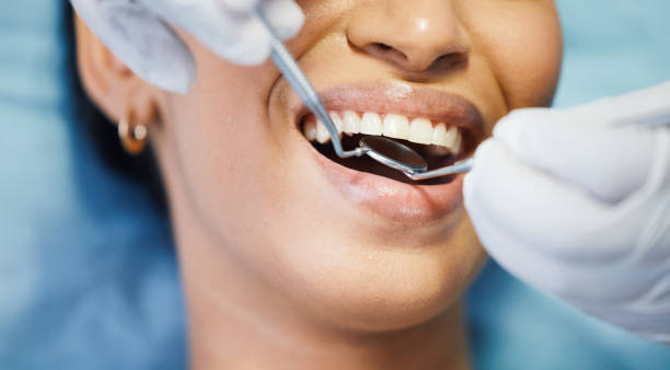 Best Walk-In Emergency Dentist in Helena, MT
